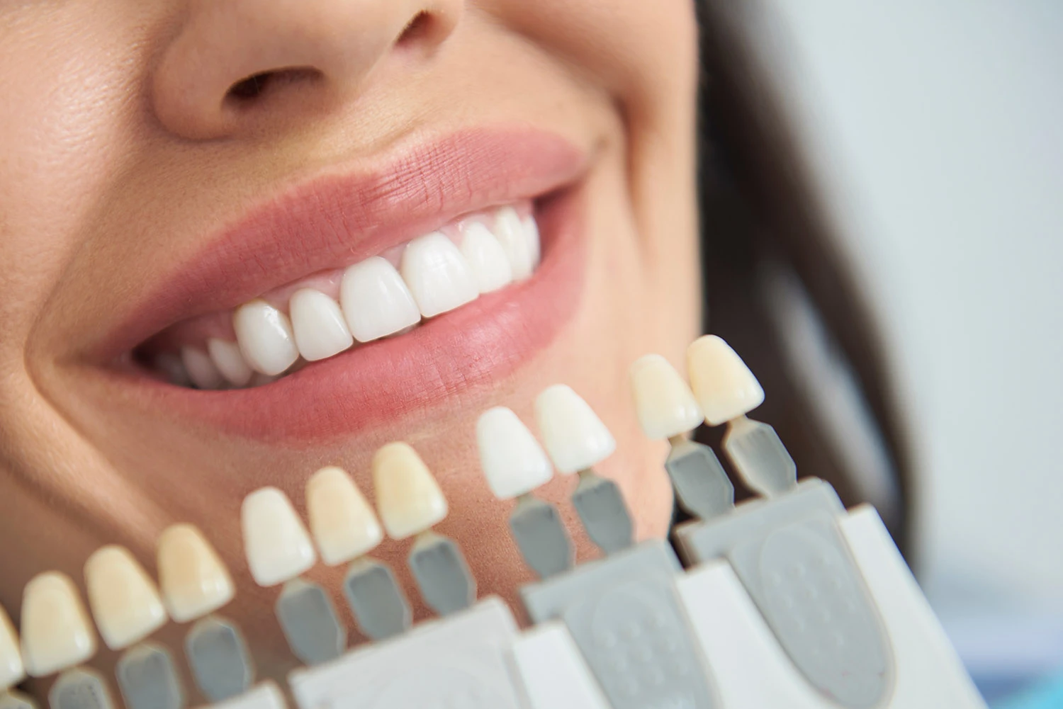 teeth whitening Warkworth Special